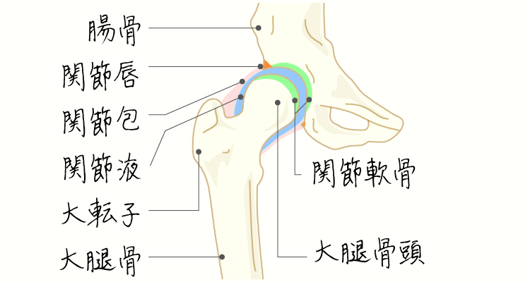 単純性股関節炎 イメージ