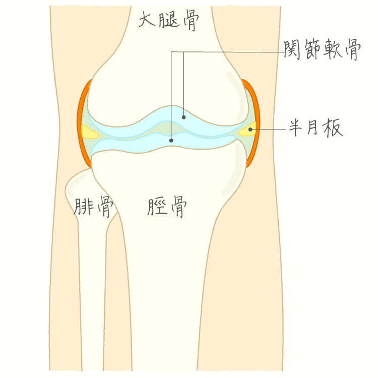 変形性膝関節症 イメージ